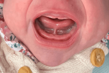 Is my baby getting enough milk? Signs to look for when you are breastfeeding